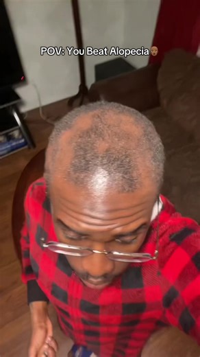 Dr.Sebi wasn’t lyin bout Batana oil #batanaoil #hair #hairgrowth | batana oil