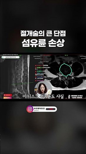 허리 절개술 vs 최신 수술법 비교
