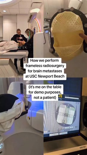 Elizabeth Zhang-Velten, MD, PhD on Instagram: "It can be terrifying to hear that you need radiation to the brain. The good news is that recent research shows that focal radiation can be used instead of whole brain radiation for even up to 20 brain metastases. At USC Newport Beach, we use mask immobilization, which patients prefer to conventional Gamma Knife frame. The mask is hard for patients to tolerate if they have claustrophobia, so we work with you and give you medicine as needed to get thr
