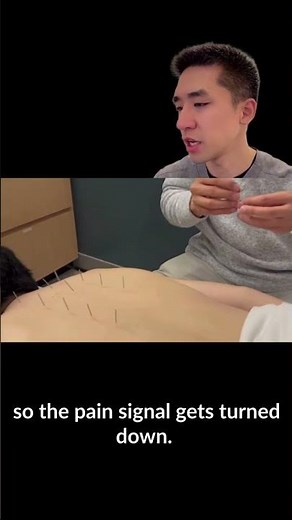 How Acupuncture Relieves Low Back Pain (It’s Neuroscience, Not Magic)