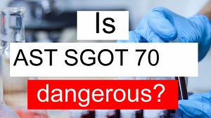 Is AST SGOT 70 high, normal or dangerous? What does Aspartate aminotransferase level 70 mean?