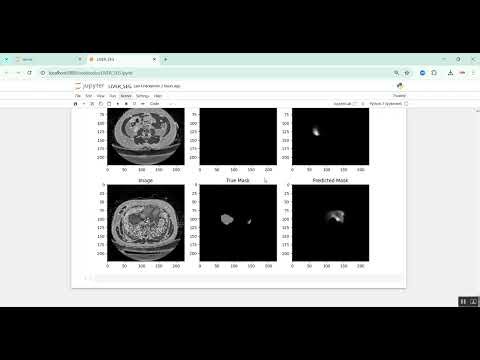 Liver Tumor Segmentation in Python Projects