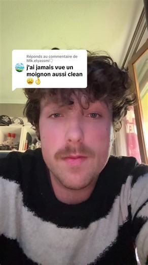 Humorous Take on Prosthetics and Clean Girl Aesthetics