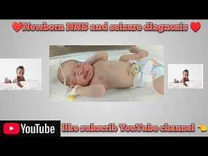 Newborn baby NNS and Seizure diagnosis ♥️♥️♥️♥️♥️