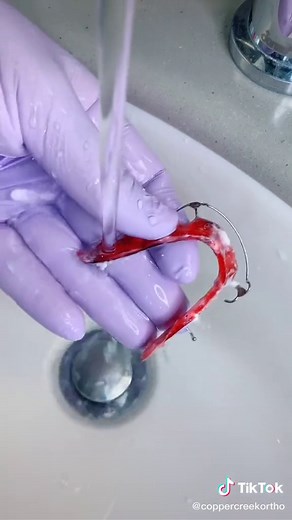 Proper Hawley Retainer Cleaning Guide