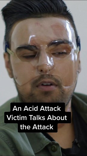 The Rise of Acid Attacks in the UK: Understanding the Threat