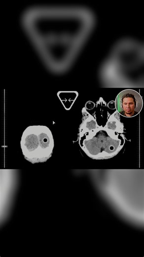 Did I Solve This Brain Scan Puzzle Wrong?! | #Endacopia #indiehorror #horrorgaming