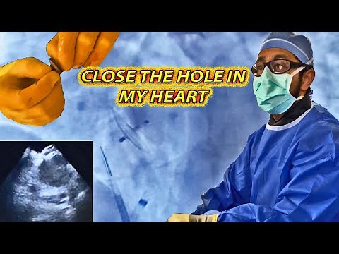 Closing the Hole in My Heart (PFO Closure) WITHOUT Open Surgery!