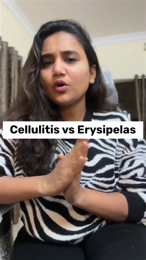 Drvaishnavi on Instagram: "Cellulitis vs Erysipelas – same redness, different depth 🔍 Learn how to spot the difference in OPD: 👉 Erysipelas – SHARP, raised & fiery red 👉 Cellulitis – diffuse, deep & poorly defined 🎥 Watch till end for easy examination points + mnemonic! #cellulitis #erysipelas #skinInfection #dermatology #surgerynotes #mbbsstudents #medstudent #medreels #clinicalexamination #opdcase #infectioncontrol #doctorreels #ayurvedadoctor #doctorsofinstagram #medicinelecture #usmle #n