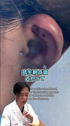 [Swollen Cartilage Piercing] It’s Severely Infected and the Piercing is Embedded! Check if Silico...