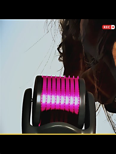 Enhance Your Skin Naturally with a Derma Roller