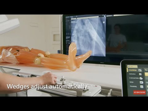 Philips Azurion - Reduce radiation using AutoWedgeFollow