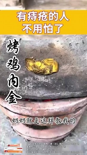 得了痔疮，先别急着动刀子，不用吃药，今天我就教你一个方法