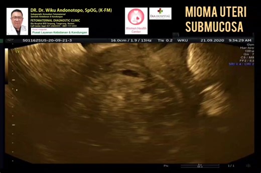 Understanding Mioma Uteri Submucous: Causes, Symptoms, and Treatment Options