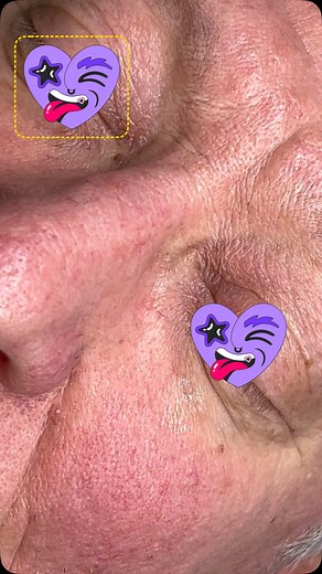 You have the power to reinvent yourself! Advanced electrolysis offers more than just skin tag removal; it paves the way for newfound confidence and self-love. Celebrate your beauty journey with every step you take! #ConfidenceBoost #ElectrolysisWorks #SelfImprovement #BeautyTransformation #RadiatePositivity#fy#fyp#skintagremoval#skincare | Soft Soles | Facebook