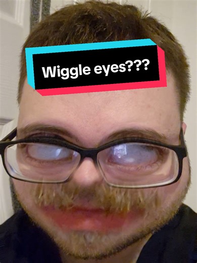 Eye Rolling Tic: Discovering My Wiggle Surprise