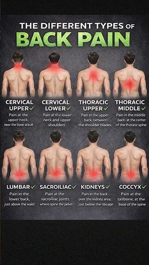 Different Types of Back Pain and What They Mean