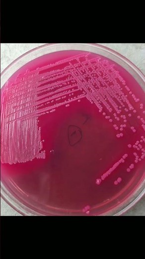 Growth of E. Coli bacteria on various type of culture medi