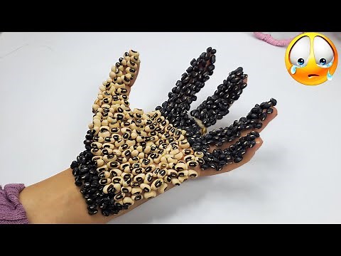 Remove white and black ticks on hand