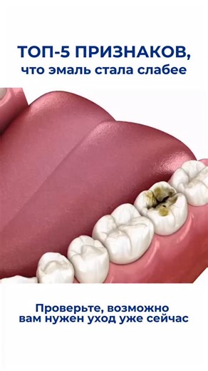 Biorepair 🇮🇹 Зубная паста, щетка | Ополаскиватель on Instagram: "🔍 После мандаринов, сладостей и газировки эмаль может стать уязвимой. Проверьте, не появились ли у вас эти симптомы: 1. Реакция на холодное/горячее – зубы «стреляют» от мороза или чая ❄️🔥 2. Оскомина от кислого – даже после мандарина чувствуете дискомфорт 🍊 3. Тусклая улыбка – эмаль потеряла естественный блеск ✨ 4. Шероховатость на языке – поверхность зубов стала неровной 👅 5. Быстрый налёт – зубы темнеют, чистки хватает нена