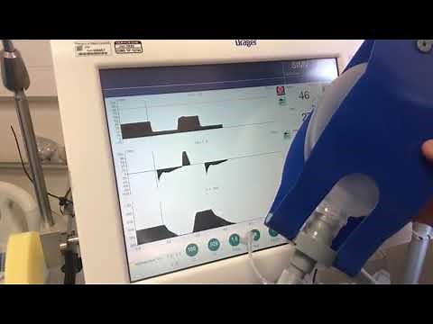 How to work out ventilator driving pressure.