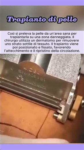Trapianto di pelle