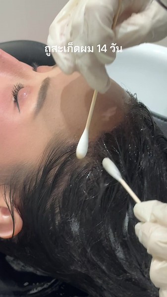 Hair Scab Care: 14 Days of Scalp Treatment
