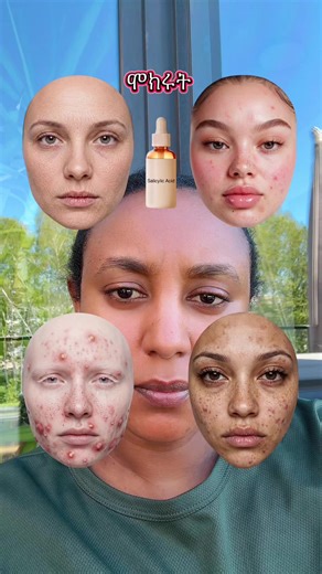 #choye#buity#skincare#