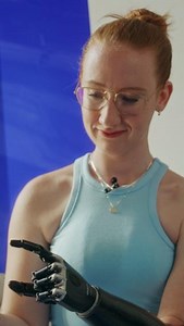 欄 Meet our inspiring users!  Enya embraces her limb difference and...