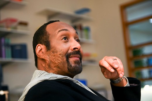 Is Jesse L. Martin's Burn Scar on The Irrational Real or Not? (DETAILS)