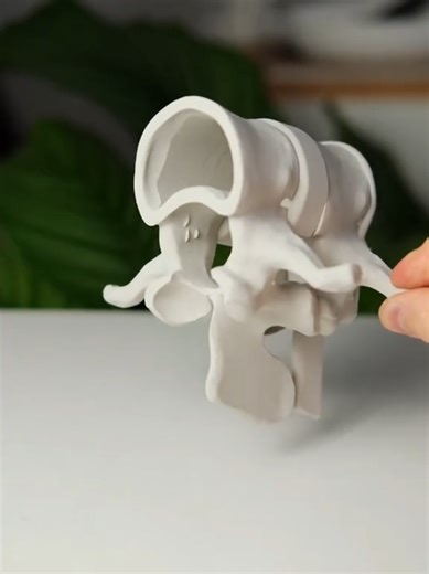 Custom 3D Printed Models for Slipped Discs