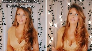 Woman shares what it’s like to have two sets of reproductive organs