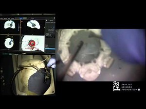 BrainPath and Synpative Demonstration by J.D. Day, MD