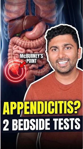 ER Doctor Reveals Two Key Appendicitis Tests