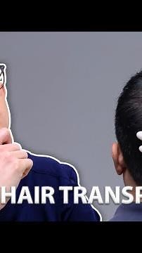 PRP vs Hair Transplant | Dr. Gary Linkov