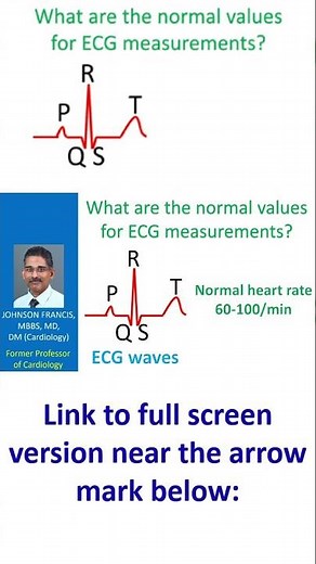 What are the normal values for ECG measurements?