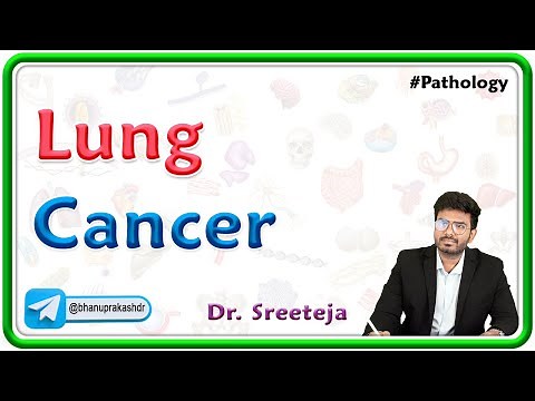 5. Lung Cancer (NSCLC and SCLC) | USMLE Step 1 Pathology