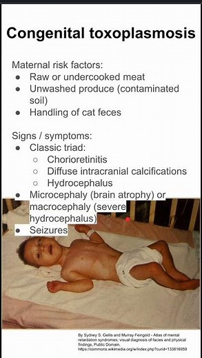 Congenital toxoplasmosis