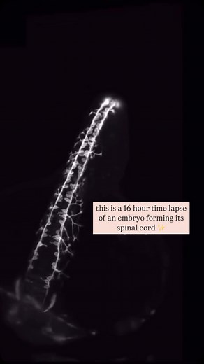 Alysha Habgood Naturopath on Instagram: "The start of an embryos nervous system – how amazing! This video is recorded by Dr. Elizabeth M. Haynes & Jiaye “Henry’ He"
