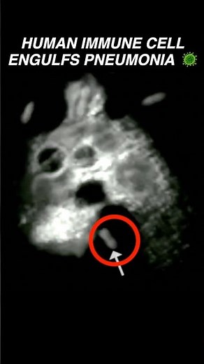 Human Neutrophil ENGULFS Pneumonia Bacteria #immunity #microbiology #immunesystem #science