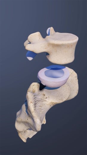 See a clear visual explanation of the L5-S1 lumbar spinal disc and what makes up the disc itself. | Spine-health