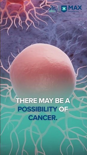 Cancer Warning Signs You Should Never Ignore