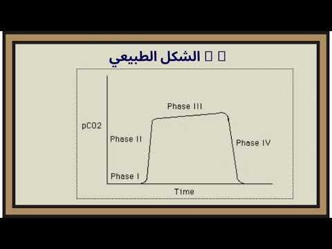 capnograph wave form analysis