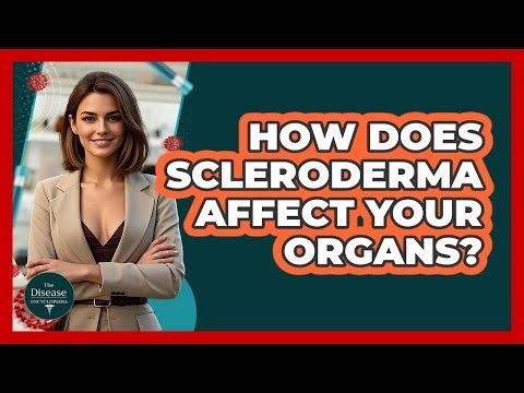 How Does Scleroderma Affect Your Organs? - The Disease Encyclopedia