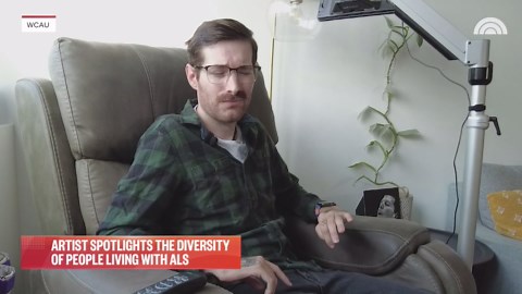 Artist with ALS spotlights diversity of people living with the disease