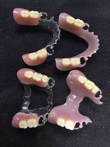 [Hot Item] Valplast Flexible Partials
