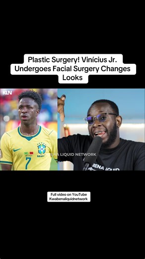 Vinícius Jr. plastic surgery: why his new look is trending