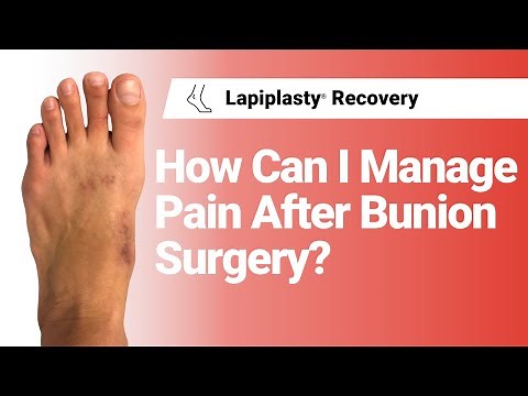 How Can I Manage Pain After Bunion Surgery? | Lapiplasty® Recovery