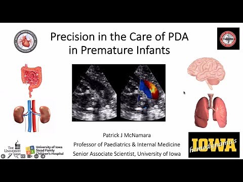 Precision in the Care of Patent Ductus Arteriosus in Premature Infants