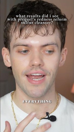 what results did i see with the prequel redness reform sulfur cleanser? 😨😨